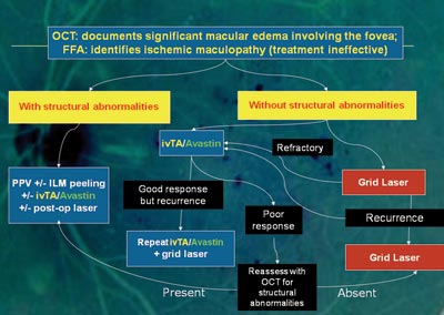 Suggested treatment algorithm for diabetic macular edema