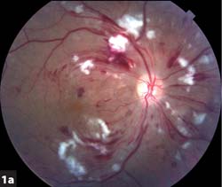 color fundus photograph, right eye