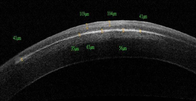 Figure 1a. Day 1