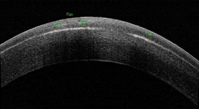 Figure 1b. Day 3