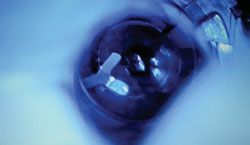 Figure 3. The patient interface allows the surgeon to stabilize the eye in the X,Y and Z axes