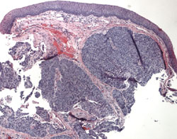 Figure 3a. Hematoxylin and eosin stain