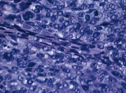 Figure 3b. Higher magnification shows multiple cells