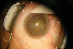 Figure 6. This shows the nucleus transected into four quadrants