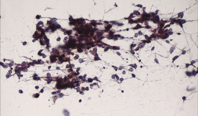 Figure 3. Hematoxylin and eosin stain