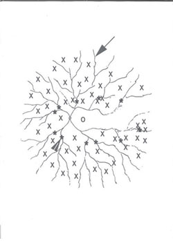 Figure 2. Retinal diagram 