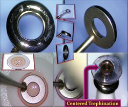 Figure 1. John K-Pro Centration Ring 