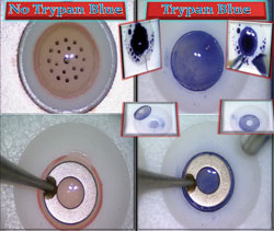 Figure 2. Donor cornea