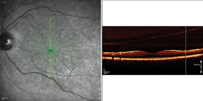 Figure 1. OCT slice is a scan