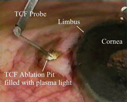 Figure 3. Transciliary filtration