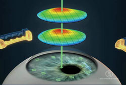 Figure 3. Diagram demonstrating pupil centroid shift. 