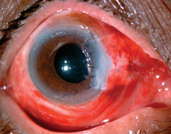 Figure 3. Day 1 postoperative picture 