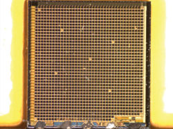 A light-sensitive chip, part of a subretinal electronic implant, is inserted into the subretinal space