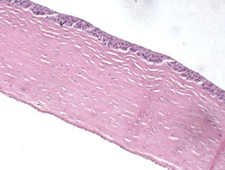 Figure 3. Photomicrograph showing the cross-sectional image of a cornea 