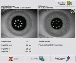 Figure 1. Iris registration being performed to compare misalignment