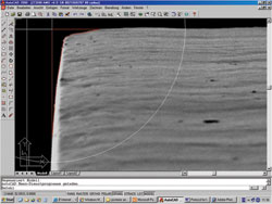 Evaluation of the microedge structure of the ZCB00 single-piece hydrophobic acrylic IOL. The arrows on the left show the area of analysis on each lens. The photos on the right are high magnification of the posterior-lateral edges of the lenses. 