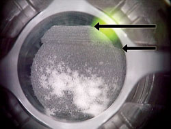 Laser energy continued to be delivered for 2 seconds from the moment of suction loss (short arrow) to the moment of foot pedal release (long arrow). After suction loss, the globe shifted slightly, leading to a discontinuity in the edge of the raster pattern. A slightly less dense, more linear pattern opaque bubble layer is present after suction release and decreased pressure on the cornea.