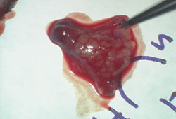 Figure 3. Tumor placed in proper orientation on marked cardboard.