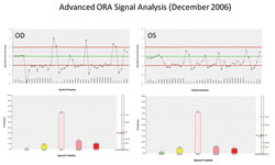 Figure 2. Advanced ORA analysis of both eyes with multiple parameters outside the two standard deviations of the normal population.