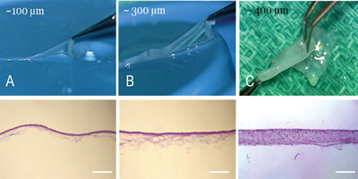 Figure 1. Comparison between the regular-thickness AmnioGraft (a), thicker AmnioGraft-G (b) and AmnioGuard (c).