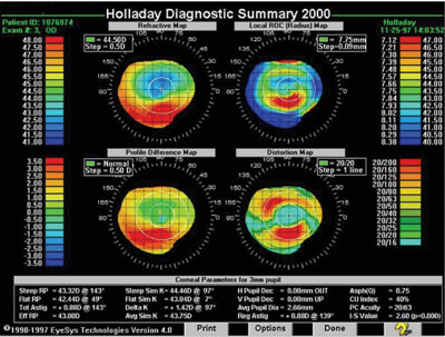 Figure 2. Holladay diagnostic summary map illustrating zonal refractive power.