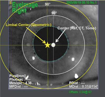 Figure 3. Optical axis and visual axis of the eye at the corneal plane. 