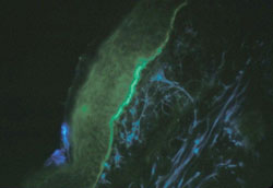 Figure 1. Basement membrane immunofluorescence of skin.