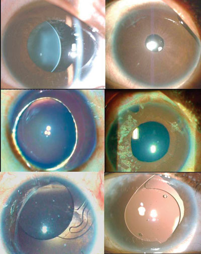 Preoperative clinical photographs