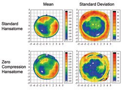 Topographic maps of the mean and standard deviation of flap thickness centered on the corneal vertex for the standard Hansatome and zero-compression Hansatome groups. The color scale represents the epithelial thickness in microns.