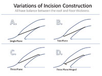 Figure 5. As long as the incision is balanced, a single (A), dual (B) or three-plane (C) incision can be successful.