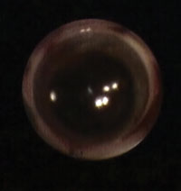 View from the endoscopic probe before entering the eye.