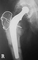 radiograph