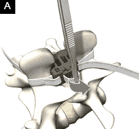 Figure 4 A