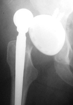 X-ray