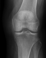 Standing radiograph