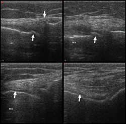 Ultrasonography