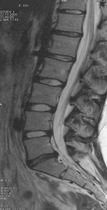 T2-weighted MR image