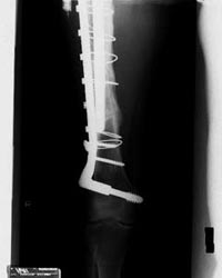 radiograph