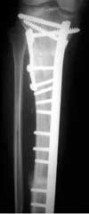 radiograph