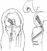 Figure 1 [drawing]