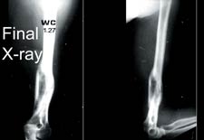 radiograph