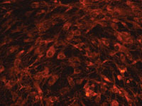 Collagen II immunpfluorescence