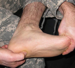 Plantar fascia-specific stretching