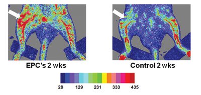 Representative laser doppler images showing increased soft tissue blood flow at the fracture site in EPC-treated specimens (white arrows).