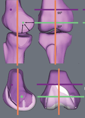 kinematic axes of the knee