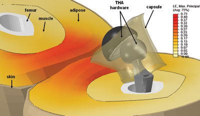 Thigh impingement arising from hip adduction during a sit-to-stand motion 