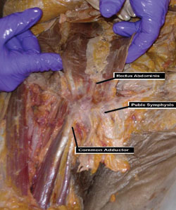 Cadaveric image demonstrating