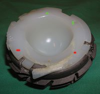 Double impingement on ceramic-on-polyethylene