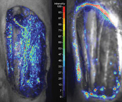 A complex musculoskeletal wound 