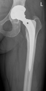 A patient is shown at 187 months follow-up and 179 months (R) follow-up